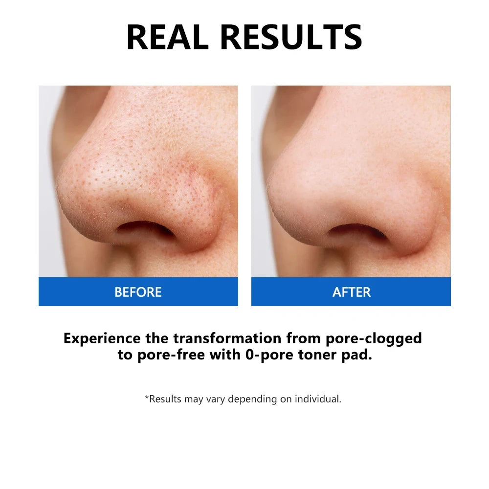 Pore Minimizing Toner Pads